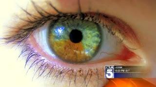 Cambio de color de ojos permanente disponible en 3 años por 5.000 dolares
