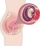 semana8 En la semana 8 del embarazo
