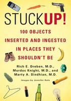 Stuck Up! imágenes de rayos X que muestra cuerpos extraños ingeridos o insertados en el cuerpo humano, por accidente o a propósito (Galería de imágenes) Stuck Up! imágenes de rayos X que muestra cuerpos extraños ingeridos o insertados en el cuerpo humano, por accidente o a propósito (Galería de imágenes)