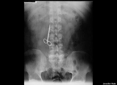 Stuck Up! imágenes de rayos X que muestra cuerpos extraños ingeridos o insertados en el cuerpo humano, por accidente o a propósito (Galería de imágenes) Stuck Up! imágenes de rayos X que muestra cuerpos extraños ingeridos o insertados en el cuerpo humano, por accidente o a propósito (Galería de imágenes)