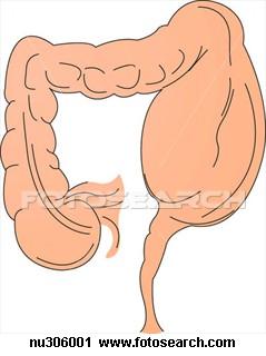 Vuestra historia clínica: Megacolon y estreñimiento