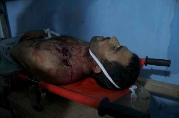 muerto DSC_0070 Crónicas desde Siria: El hospital de los milagros y otras….