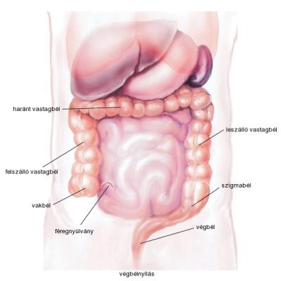 Colitis ulcerosa Colitis ulcerosa