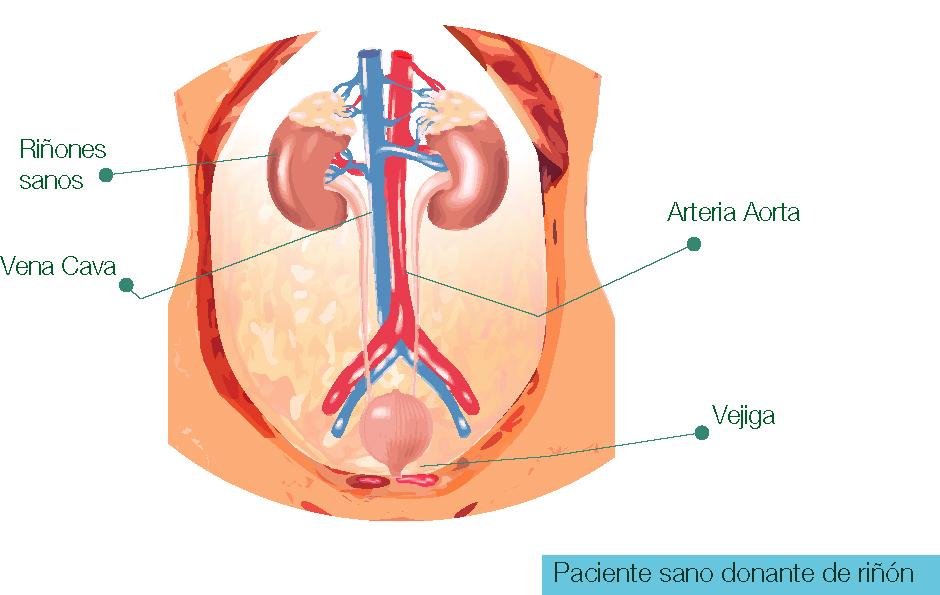 Infección urinaria en niños y enfermedad renal crónica