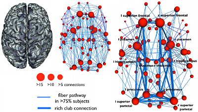 Hubs en el cableado neuronal del cerebro Actualidad Informática. El cableado del cerebro tiene