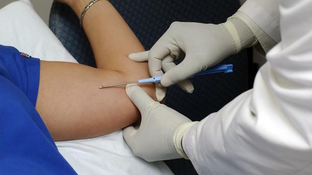 Implante-anticonceptivo Implante anticonceptivo Beneficios de los implantes anticonceptivos