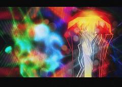 Complicaciones de la cirugía refractiva Complicaciones de la cirugía refractiva