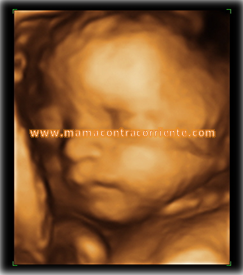 eco 4D blog Ecografía 4D