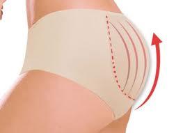 hilos-tensores Hilos tensores para la flaccidez