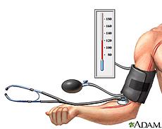 Memoria de mi enfermera XXXVII: ¿Yo tengo tensión? Hipertensión Arterial, la gran desconocida. Memoria de mi enfermera XXXVII: ¿Yo tengo tensión? Hipertensión Arterial, la gran desconocida.