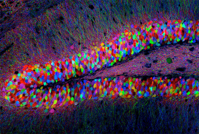 Imagen del hipocampo de un ratón transgénico. Fuente: Nikon Small World Gallery
