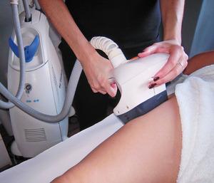 Celulitis y VELA SMOOTH Celulitis y VELA SMOOTH