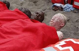 El Gobierno español concede asilo como refugiado a un emigrante negro albino en peligro de muerte