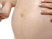 Especial embarazo: mantener estrías raya