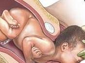 Ginecología Obstetrícia