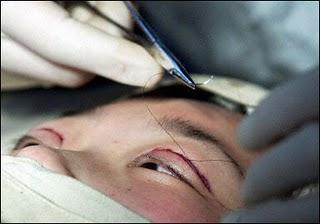 7 Recomendaciones antes de una Cirugia Estetica