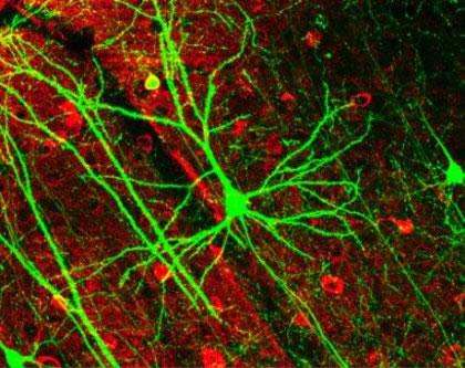 Detectadas las neuronas espejo en humanos