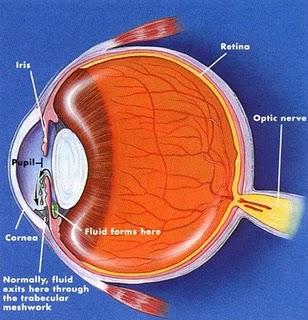 ¿Qué es...?: El glaucoma