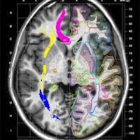 Elsevier presenta Atlas de RM de materia blanca humana para iPad