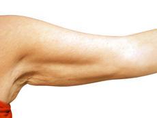 brazos murcielago Qué son las alas de murciélago