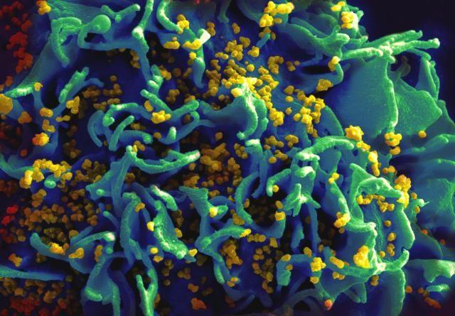 Efectos positivos de la  «superinfección» del VIH
