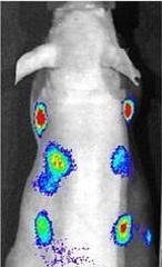 Proteínas luminosas que avisan del cáncer