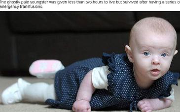 Olivia Norton nació con los niveles de hemoglobina en mínimos