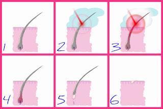TRND: Proyecto PeloStop