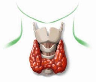 tiroides Remedios nutricionales contra la tiroides