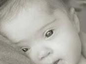 Mundial Síndrome Down- marzo