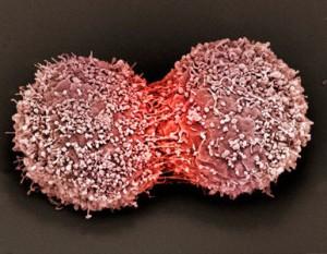 El Uso Prolongado De Hormonas Incrementa El Riesgo De Cáncer