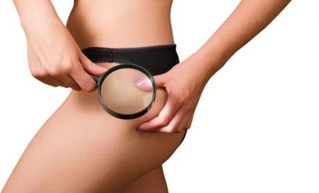 Dieta para no acumular celulitis