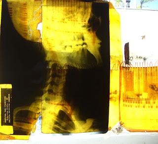 Destacada participación y una alta calidad en el  “Concurso Iberoamericano Instituto Roche” (Photo MP’11)