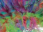 Escaner cerebral detectaría Alzheimer 1.600$