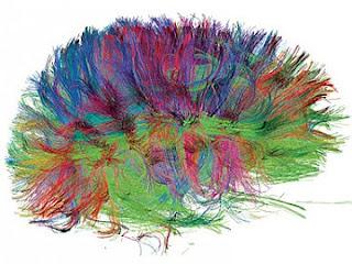 Escaner cerebral detectaría Alzheimer por 1.600$