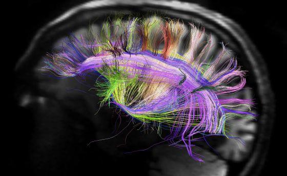 Una nueva tecnología permite trazar el mapa de las conexiones neuronales