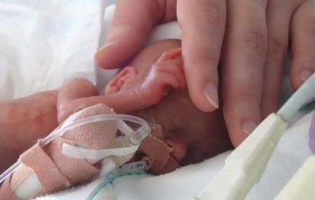 Los bebés muy prematuros pueden desarrollar hipertensión