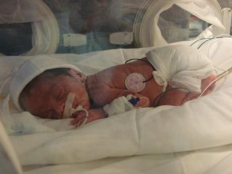 luz-milagros Bebé prematura nace muerta en Argentina y tras 12 horas en la morgue vuelve a la vida