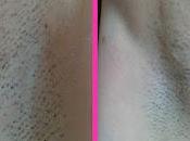 TRND: Proyecto Pelostop