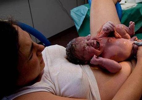 Qué es el parto ambulatorio