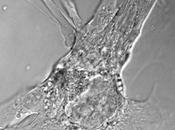 Células reprogramadas para infarto