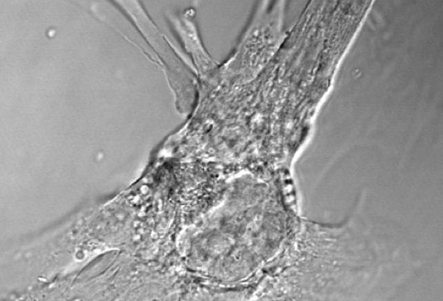  Células reprogramadas para el infarto