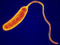 Mutaciones hacen mas Peligroso al Vibrio Colera