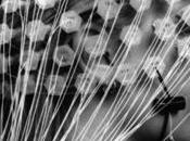 Electroencephalogram figHead Scholarpedia