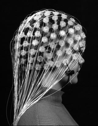 Electroencephalogram figHead - Scholarpedia