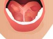 "frenotomanía" "cortar frenillo" bebé