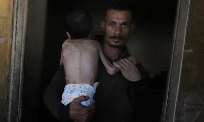 Bloqueo de alimentos de Israel