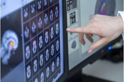 Como la respiración influye en la actividad cerebral y en el comportamiento