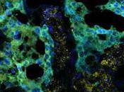estudio sobre placenta identifica primeros signos autismo