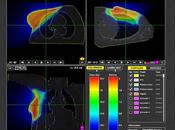 Computación distribuida aplicada Medicina: Oncología Radioterápica